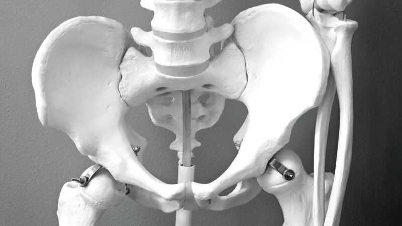 Are your bones brittle? If they were, how would you know? (To men: this goes for you too) | Ranjana Srivastava